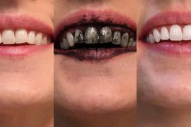 Review bột trắng răng than hoạt tính Procoal