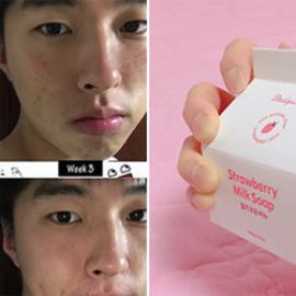 Xà phòng trị mụn Hàn Quốc Strawberry Milk Soap Daily Skin